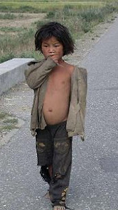 el niño mas pobre del mundo.jpg